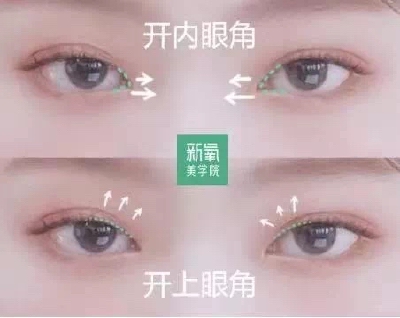 有开上眼角+内眼角，复习一下什么是开上眼角