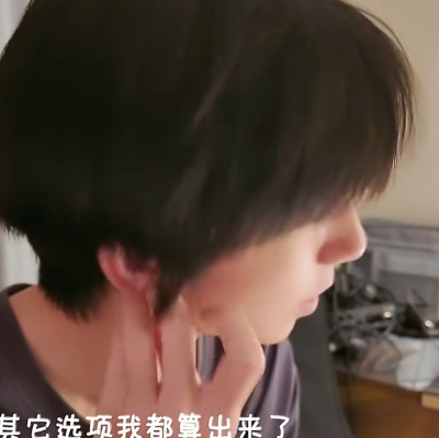 主播为什么算不出来DNA片段上一条链上嘌呤比例是多少啊