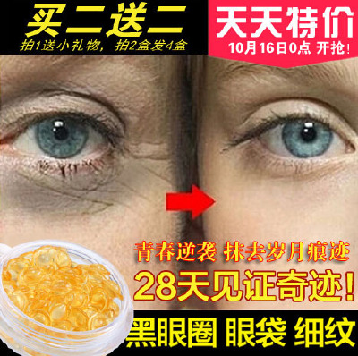 天天特价眼霜特效去除黑眼圈细纹祛眼袋脂肪粒补水抗皱纹紧致男女